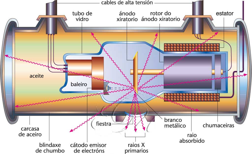 Opiniones de Tubo de rayos X