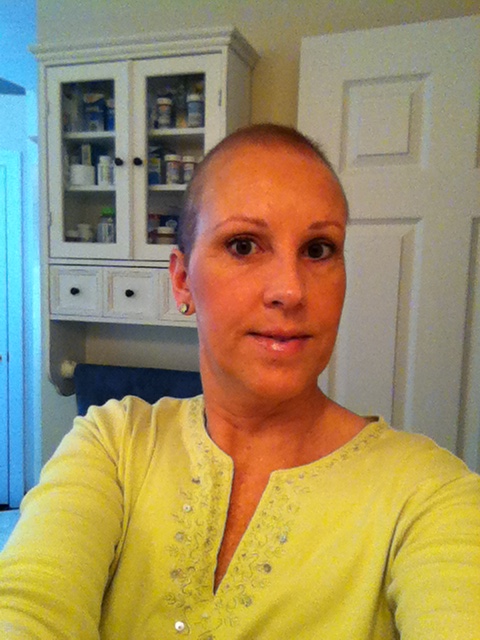 The Tamoxifen Diaries Hair Regrowth And Miaderm
