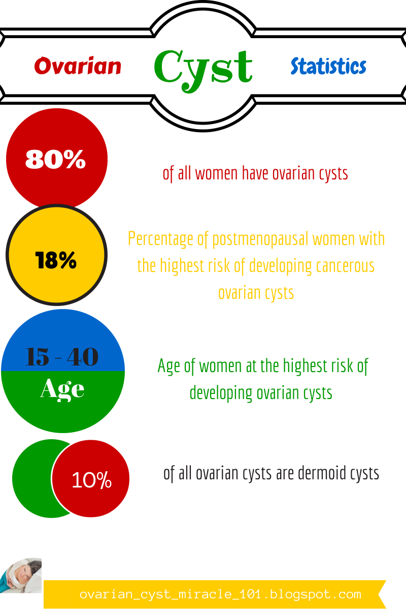 Ovarian Cyst Miracle 101  May 2014