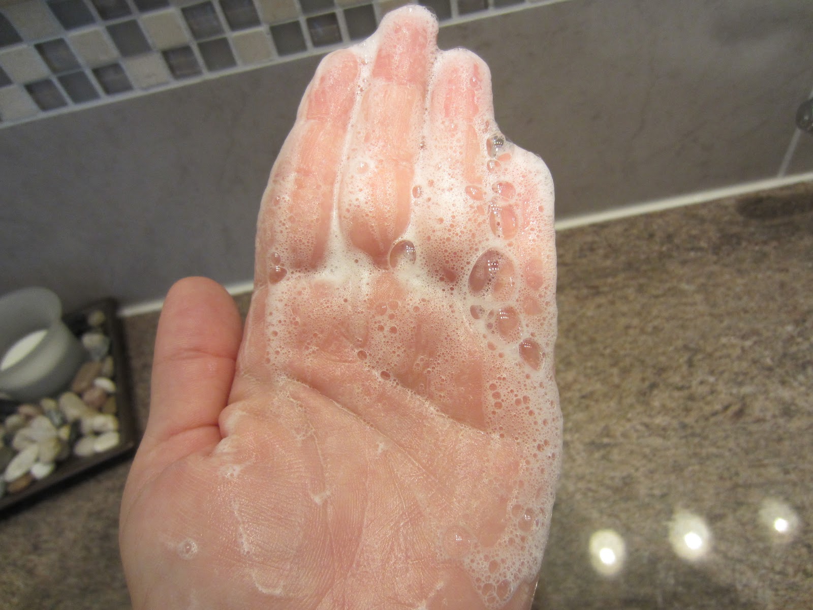 Car battery pole size chart, car battery acid skin allergy, how to fix a makita 24v battery