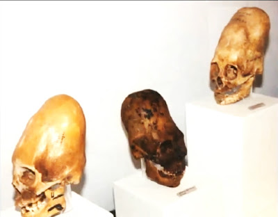 cranii de hibrizi umano-extraterestrii sau cranii ale unor oameni ce au trait in urma cu foartemult timp si care au capatat o forma de alungire a capului determinata chiar de catre parinti,pentru a servi in scopuri ritualnice deosebit de stranii