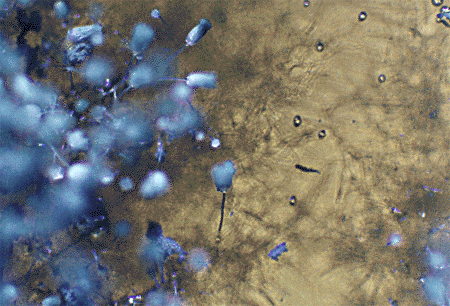 Aspergillus Restrictus