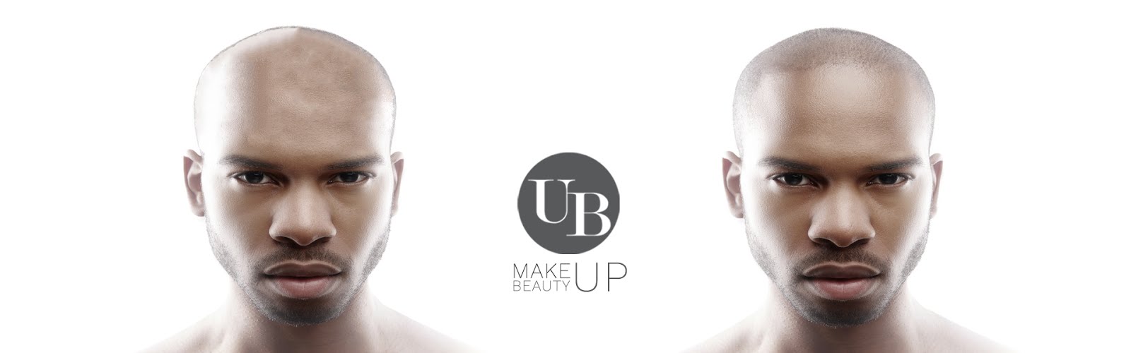 Toronto Scalp Micropigmentation