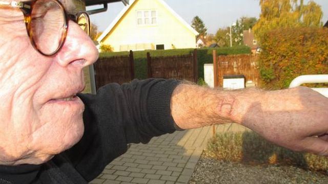 Apple-Watch-burns-a-mans-hand Apple-Watch-burns-a-mans-hand