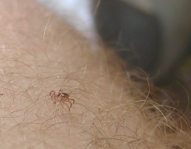 The Unlucky Hunter Attack of the Chiggers!