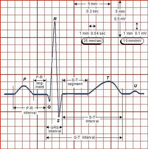12 Lead Ecg Placement Video