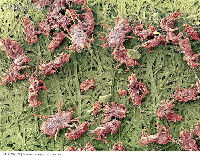 Carpet cleaning to reduce allergies Art of Clean UK 01223 863632