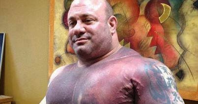 Scott Mendelson After He Tore His Pec Breaking The World Record