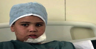 فيديو..أصغر طفل مصاب بالتحرير