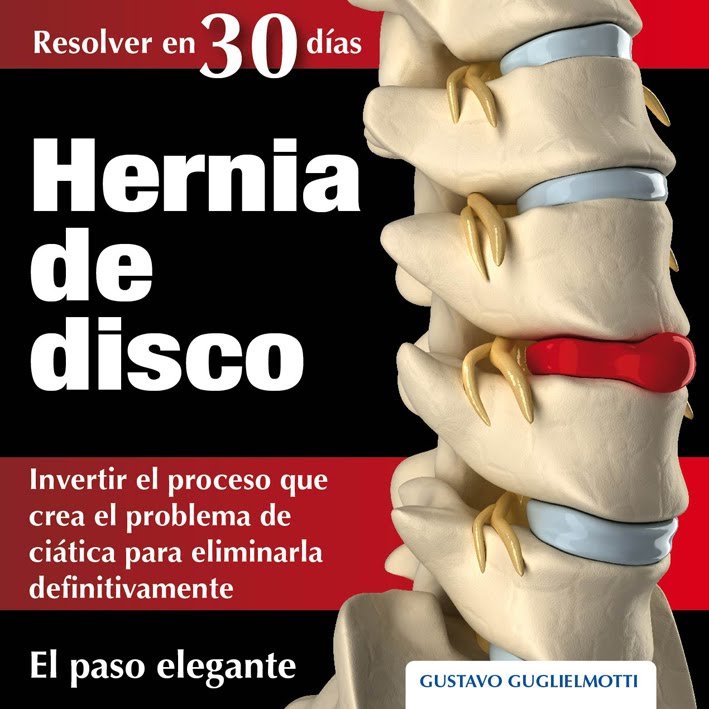Hernia de disco