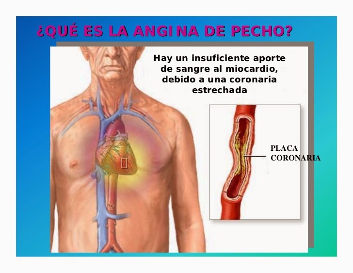 La vejiga completo del dolor en la espalda