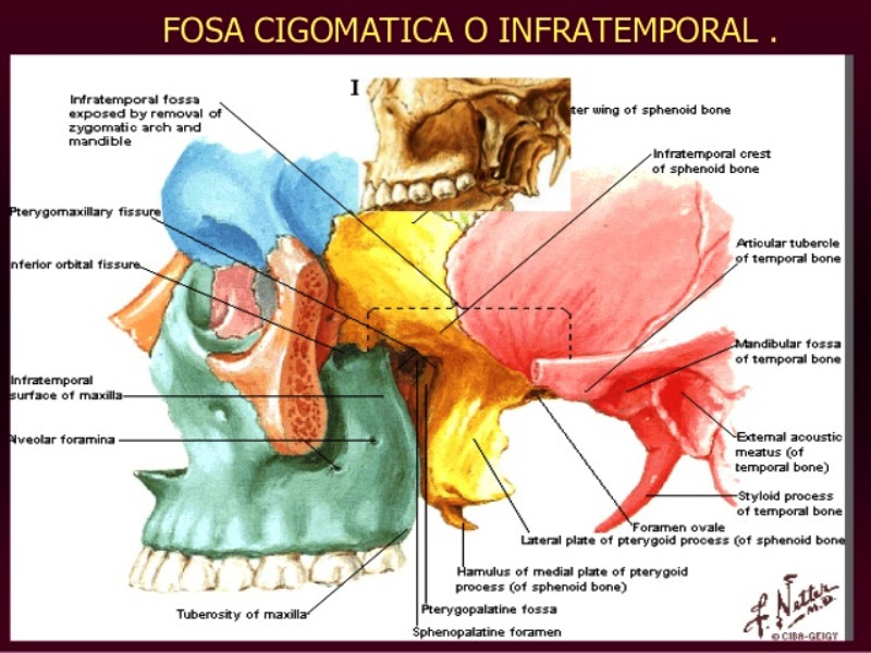 Diagnostico X Fosa Pterigopalatina