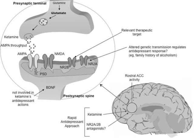 Ketamine Depression Research Trials