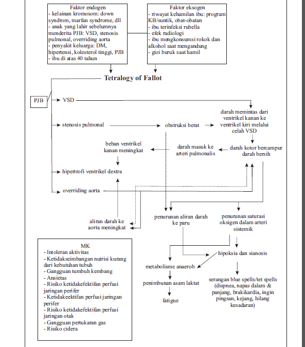 Patofisiologi Tetralogi Fallot Pdf
