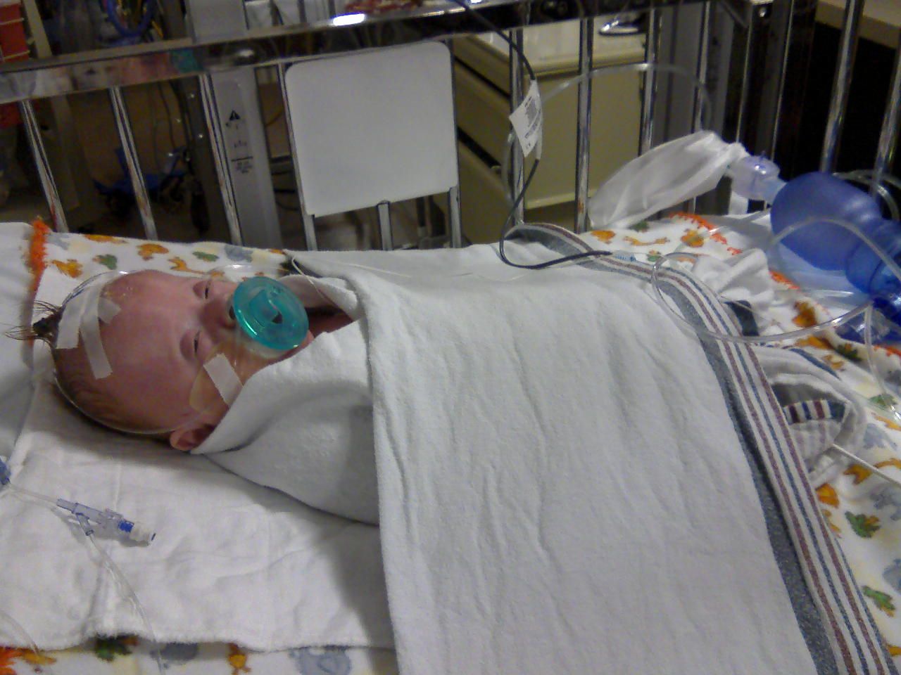 DaisyTurtle Tales GTube surgery