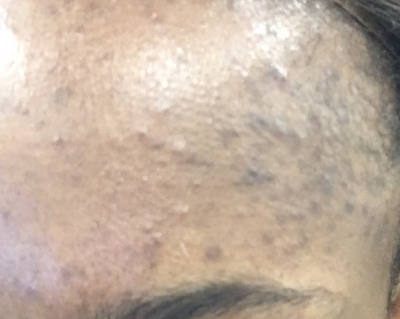 Synthetic Hair Almost Ruined My Skincare Blogger Life Skin First Daily