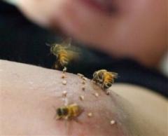 عندما تلدغ النحلة الإنسان فأنها تدخل نقطة شفافة فـي جسمه وهذه النقطة هي سم النحلة اضغط على الصورة لمشاهدة التفاصيل