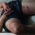 Dois menores de idade, procedentes de Parnaíba foram executados brutalmente no CEM de Teresina
