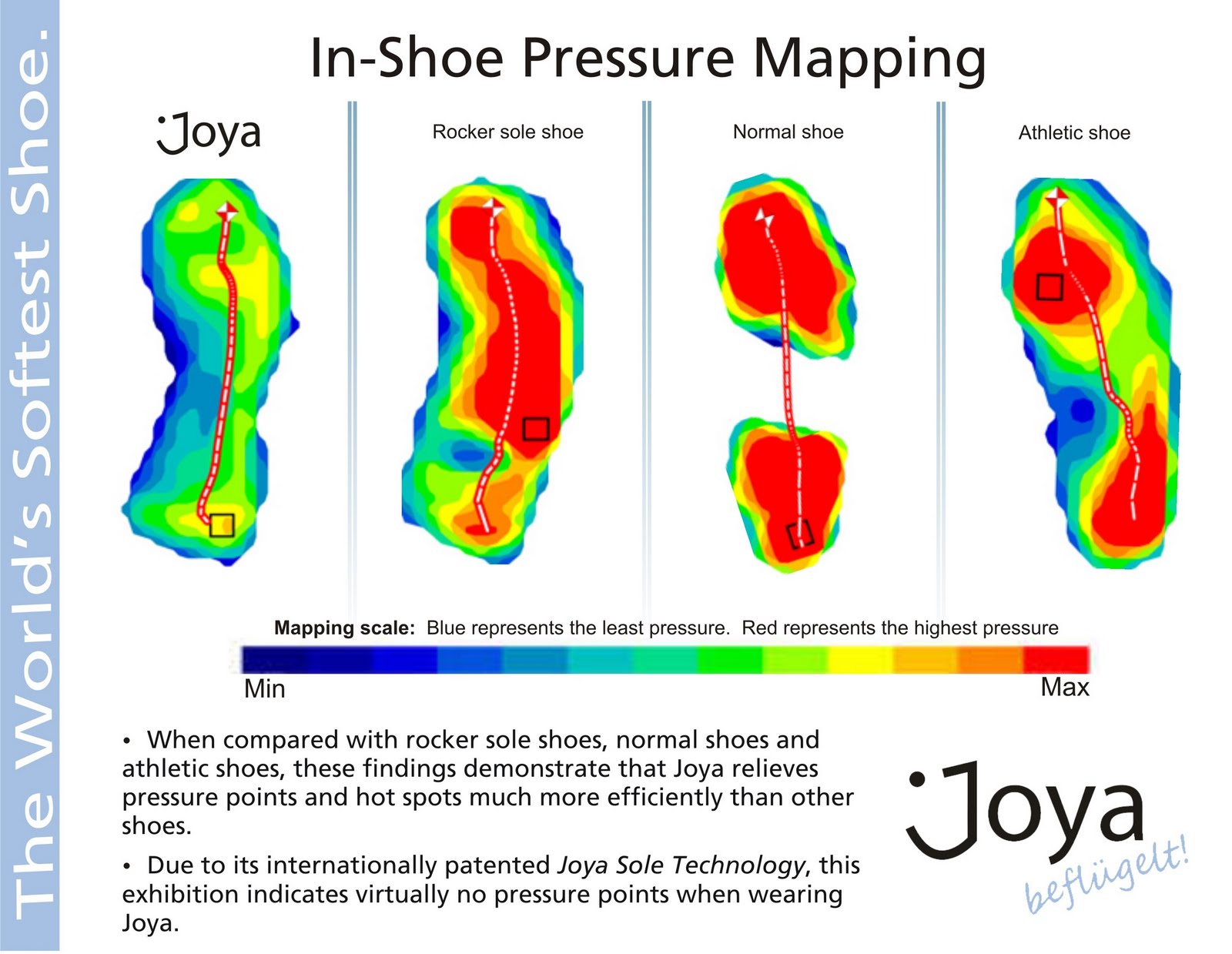 Overpronation