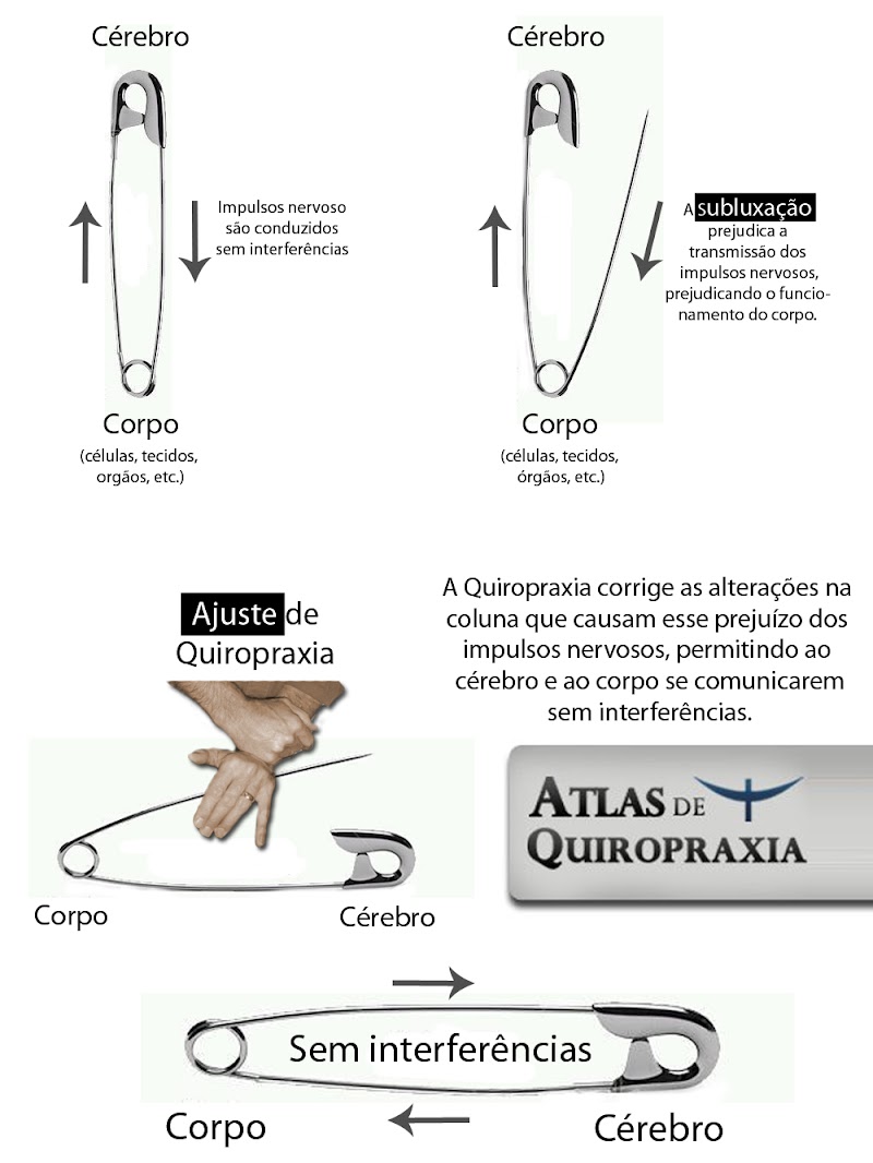 O ciclo do alfinete - Informações para todos