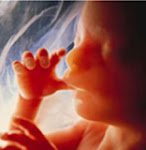 O ABORTO matará 120.000 bebes hoje