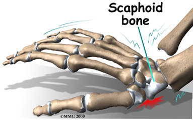 Scaphoid Process
