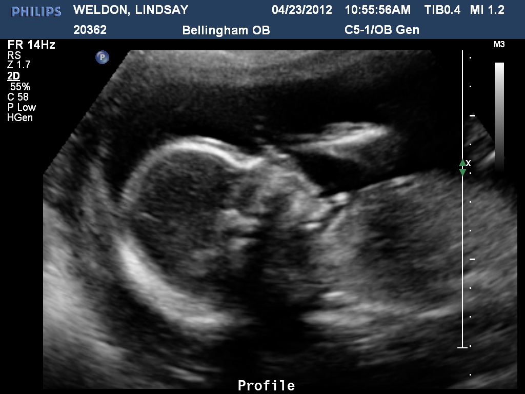 Mr. and Mrs. Weldon 20 Weeks Pregnant means&hellip;20 Week