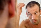 8 natural tips to prevent hair loss