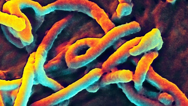 O maior risco na protecção do Ébola é a remoção do fato