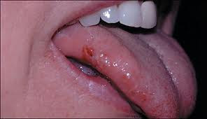 نقره لتكبير أو تصغير الصورة ونقرتين لعرض الصورة في صفحة مستقلة بحجمها الطبيعي