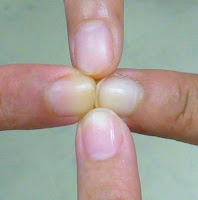 AromaKasih: Apa Yang Perlu Anda Tahu Tentang Kuku