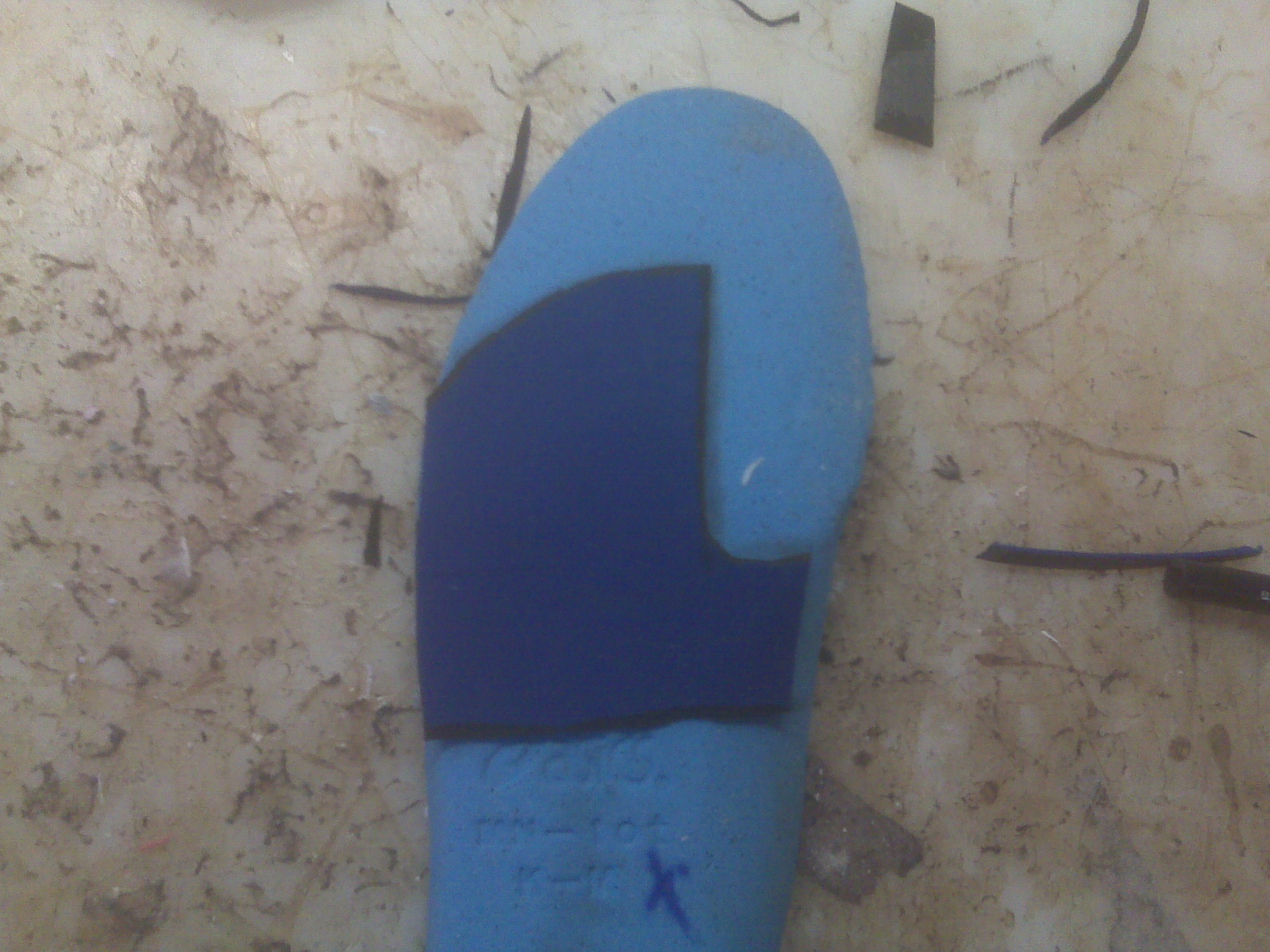 Sesamoid fracture radiopaedia bipartite Foot and Ankle Problems By Dr. Richard Blake: Sesamoid Injury: Email Advice