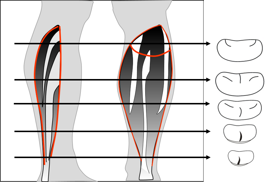 Adaptació / Adaptation Soleus muscle injury sensitivity of ultrasound