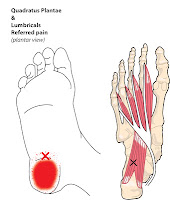 Plantar Fasciitis,Pes Planus,Mallet Toe,High Arched Feet,Heel Spur,Heel Pain,Hammer Toe,Hallux Valgus,Foot Pain,Foot Hard Skin,Foot Conditions,Foot Callous,Flat Feet,Fallen Arches,Diabetic Foot,Contracted Toe,Claw Toe,Bunions Hard Skin,Bunions Callous,Bunion Pain,Ball Of Foot Pain,Back Pain