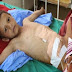منظمة "هيومن رايتس" تزور ومناطق ومستشفيات في صعدة