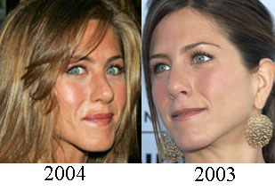 Jennifer Aniston Plastic Surgery Before and After Nose Job and Facelift.