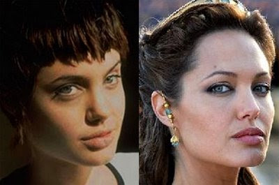 Angelina Jolie Plastic Surgery Before And After