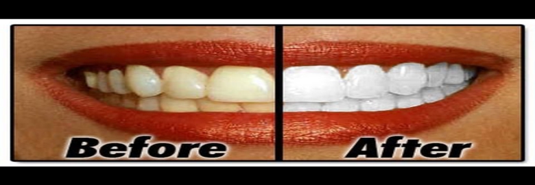 Zdrowe Białe Zęby