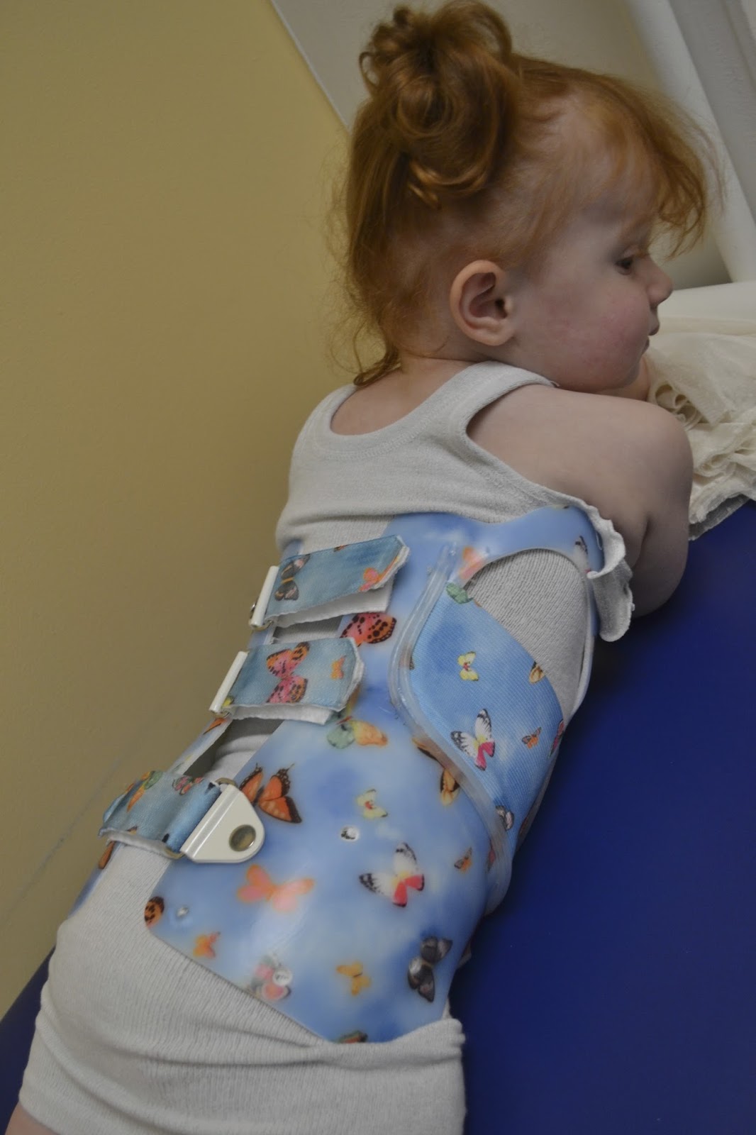 Scoliosis treatment for children