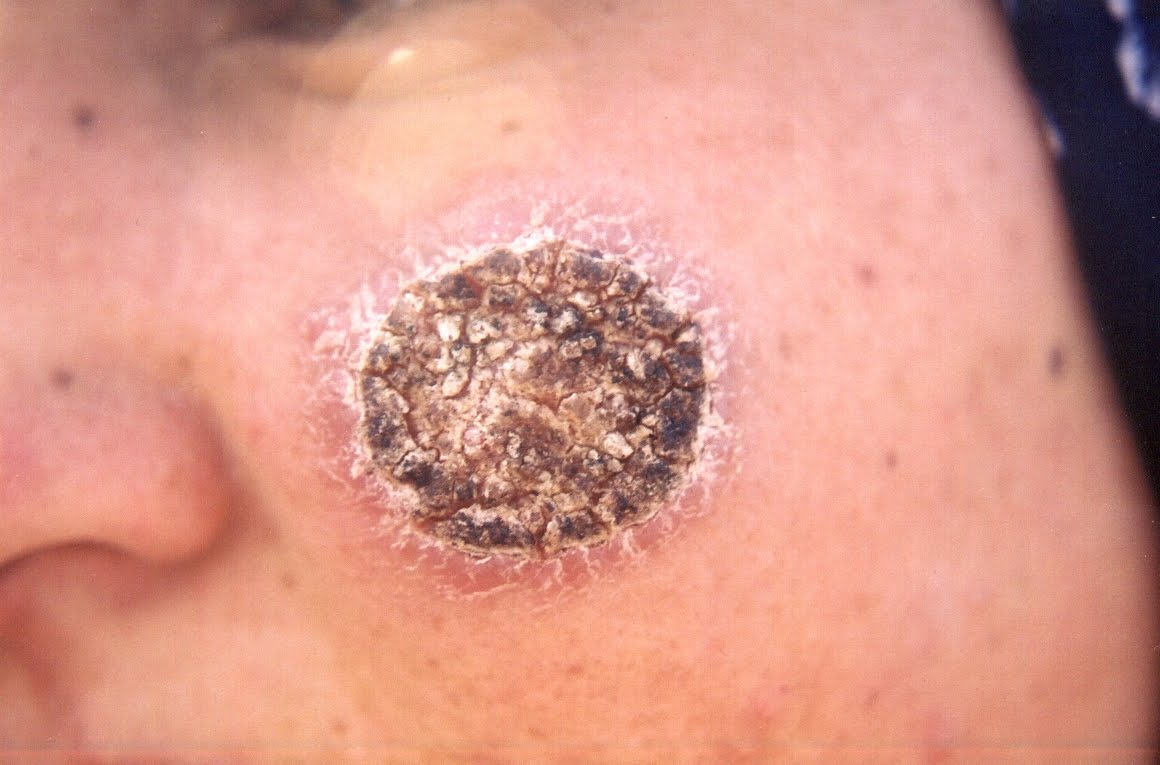 Spot Diagnosis