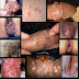 Jual Obat Kutil Kelamin Alami Terbaik thumbnail