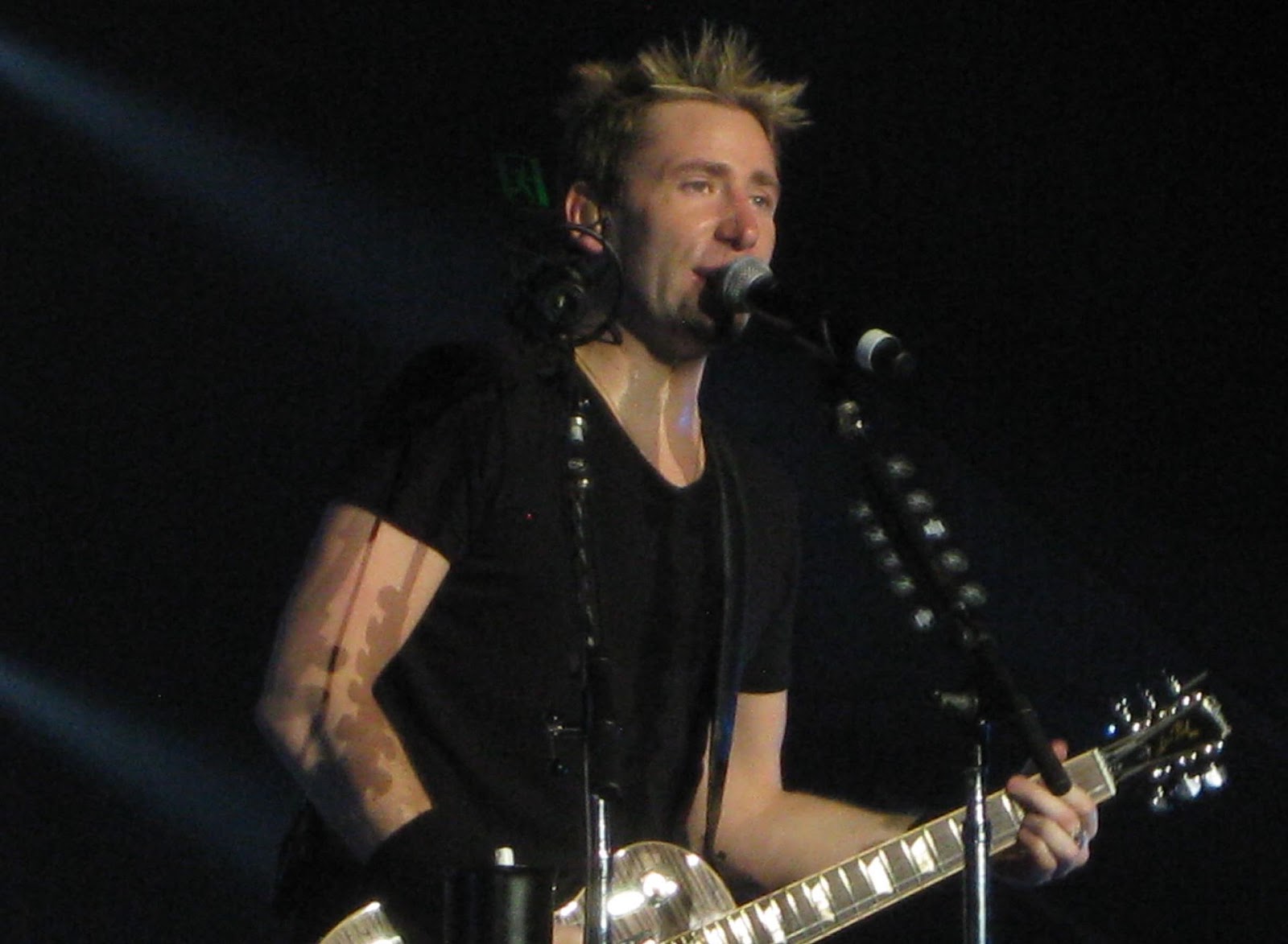 Lead Singer Chad Kroeger Has Vocal Cord Cyst Fauquier ENT Blog