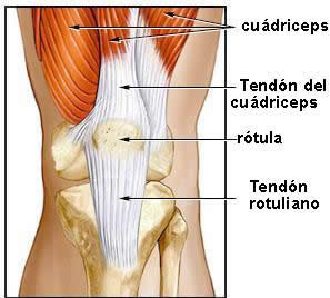 LESION TENDON lesion tendon: