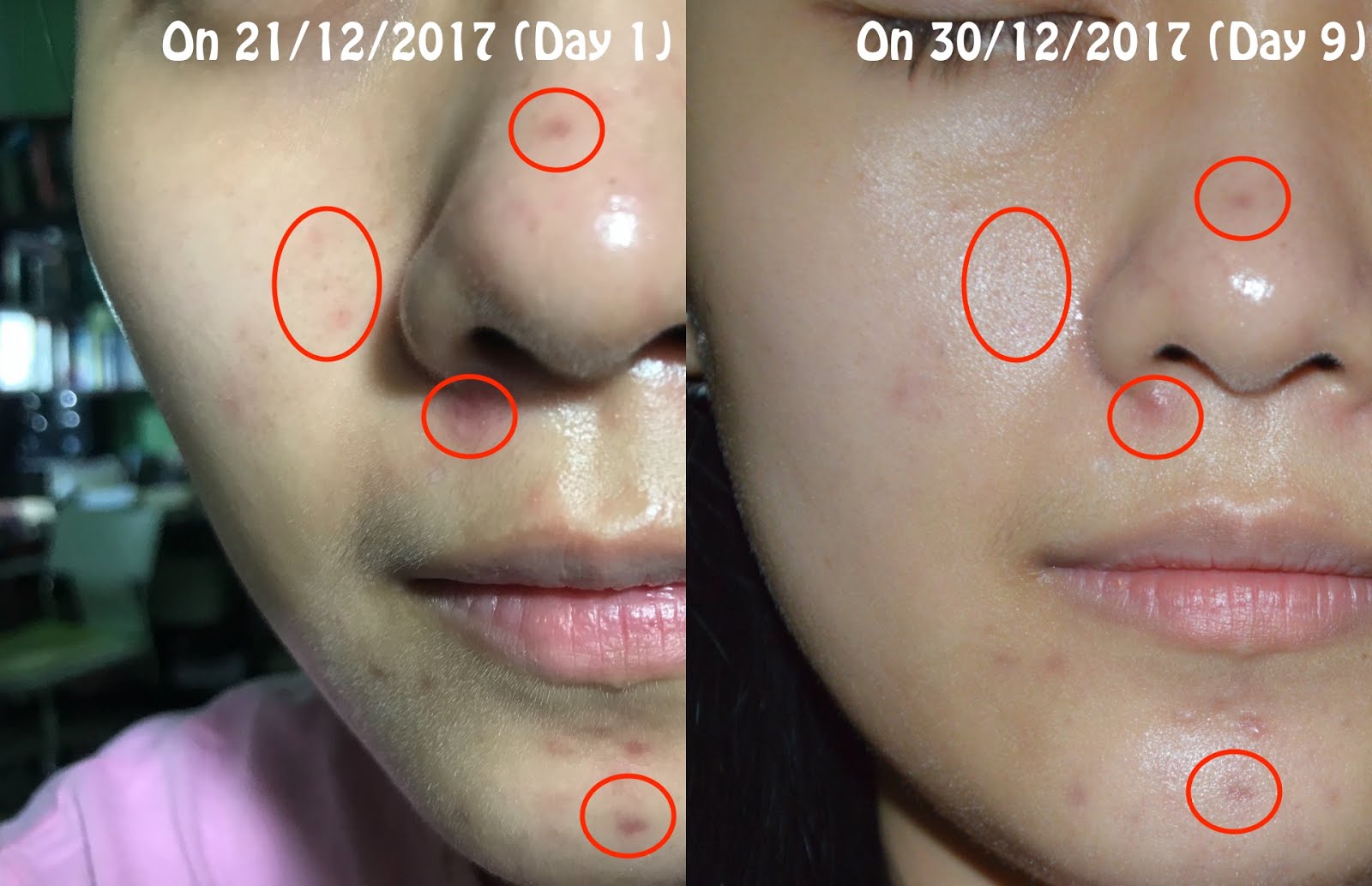 REVIEW By Wishtrend Pure Vitamin C 21.5 Advanced Serum So High