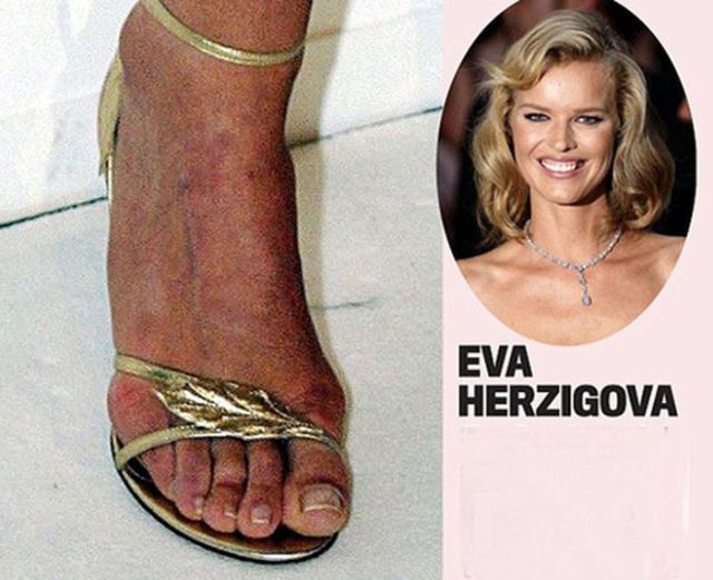 Beautiful Celebrities With Ugly Feet - FunnyMadWorld
