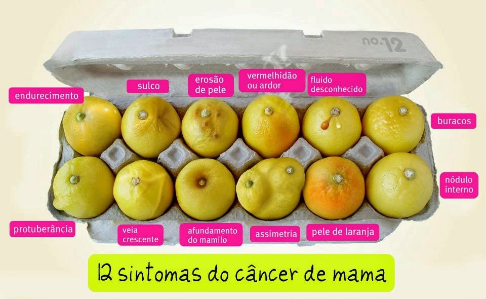 Câncer de Mama