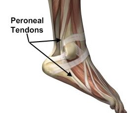 Peroneal