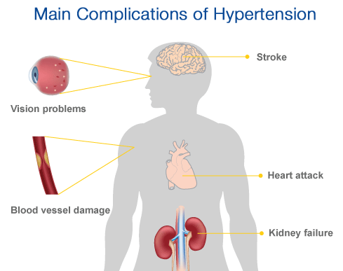 what are the major complications of hypertension