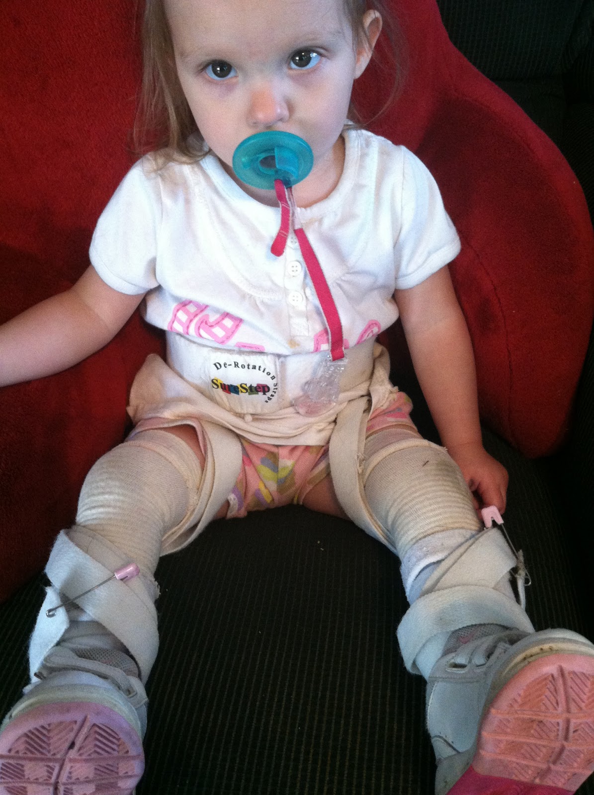 Rachel's Journey with Spina Bifida DeRotation Straps Tutorial