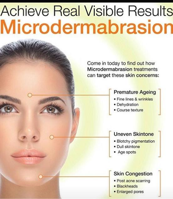 Microdermabrasion Treatments for Acne, Scars, Wrinkles